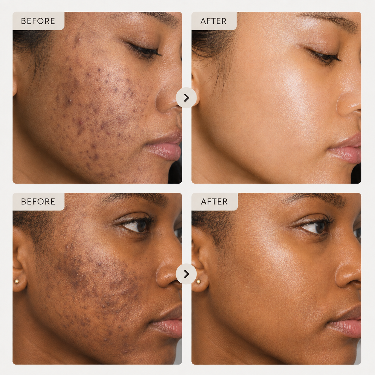 Aurelle Tone Recovery Cream
