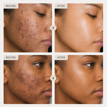 Aurelle Tone Recovery Cream