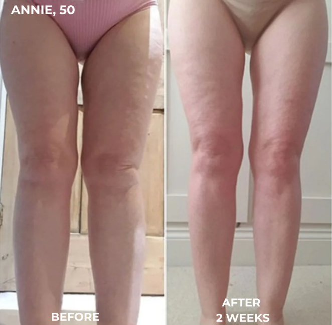FasciaBlade