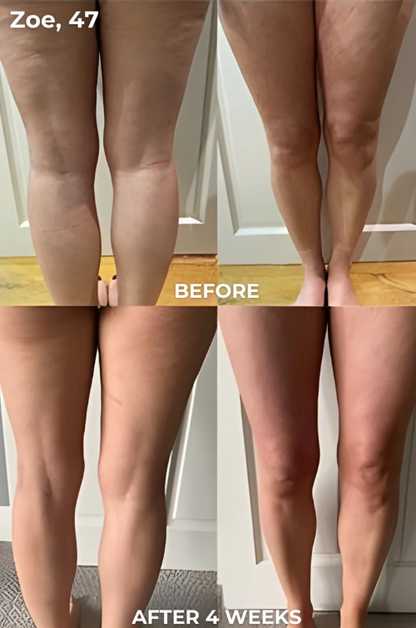 FasciaBlade