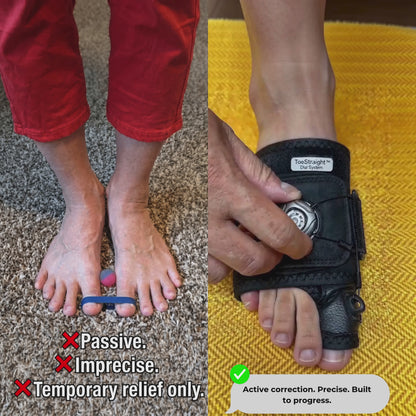 Toe Straight